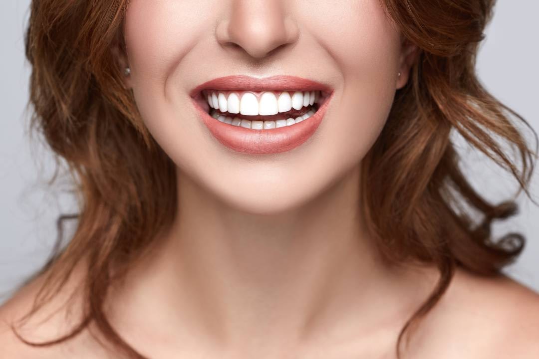 how much do veneers cost