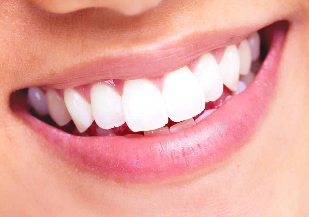 white teeth